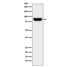 Prothrombin Antibody