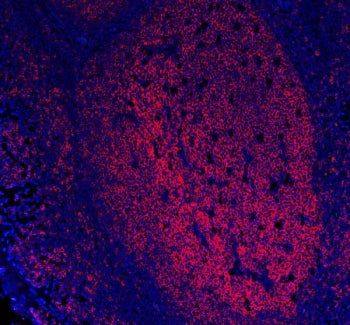 CD20 Antibody