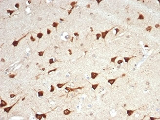 IHC staining of FFPE human brain tissue with LPLUNC1 antibody (clone LPLUNC1/7059R). HIER: boil tiss