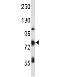 TP63 Antibody