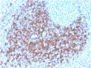 CD23 Antibody