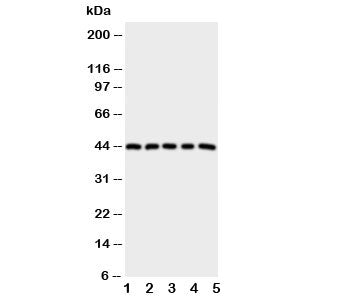Western blot testing of PGE Receptor antibody and Lane 1: HeLa; 2: A549; 3: MCF-7; 4: MM231; 5: MM45