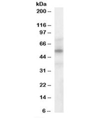 Western blot testing of human spleen lysate with LXRA/B antibody at 1ug/ml. Predicted molecular weig