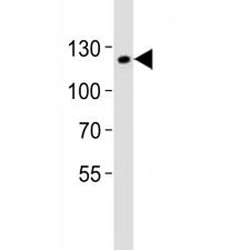 Western blot analysis of lysate from mouse F9 cell line using SIRT1 antibody at 1:1000. Predicted mo