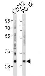 Bcl-2 Antibody