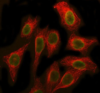Immunofluorescent staining of FFPE human U-2 OS cells with SBDS antibody (green) and Beta Tubulin mA