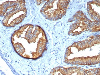Beta Tubulin Antibody / TUBB