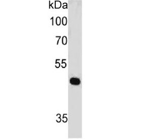 Western blot testing of human HeLa cell lysate with PAX7 antibody (clone PAX7/497). Expected molecul