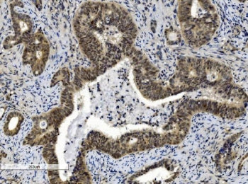 CBX8 Antibody