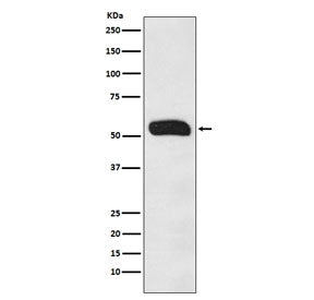 Western blot testing of human plasma lysate with Human IgG antibody. Predicted molecular weight ~50 