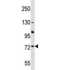 ACOX2 Antibody / Peroxisomal acyl-coenzyme A oxidase 2