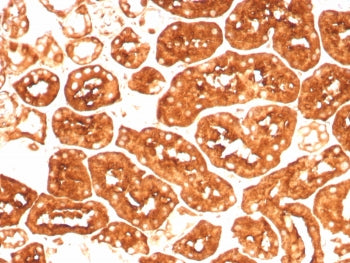 FTH1 Antibody / Ferritin heavy chain