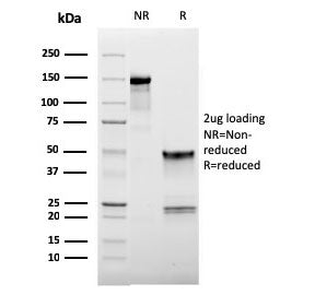 SDS-PAGE analysis of purified, BSA-free L-Selectin antibody (clone LAM1-116) as confirmation of inte