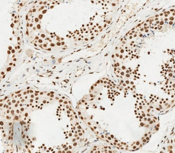 HSPA7 Antibody
