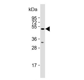 Western blot testing of human HeLa cell lysate with AMSH-like protease antibody. Predicted molecular weight ~50 kDa.