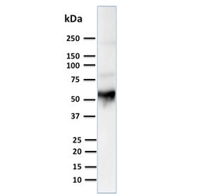 Western blot testing of human thymus lysate with Cytokeratin 10 antibody. Predicted molecular weight