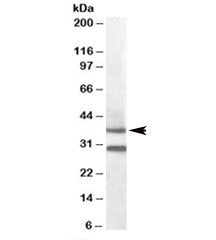 MC5R Antibody