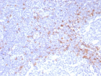 IgD Heavy Chain Antibody