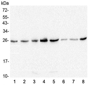 GSTM1 Antibody