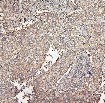MVP Antibody / Major Vault Protein
