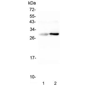 Western blot testing of 1) rat liver and 2) mouse liver tissue with Serum Amyloid P antibody. Predic