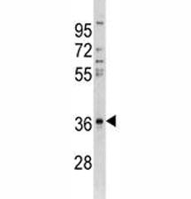 CTGF Antibody