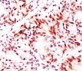 Estrogen Receptor beta Antibody