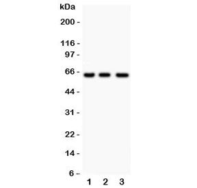 Western blot testing of RELA antibody and human samples 1: Jurkat; 2: COLO320; 3: HeLa lysate. Expec