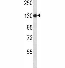 TLR8 Antibody