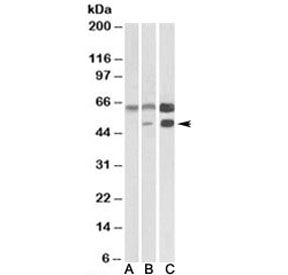 Western blot testing of human cerebellum [A], mouse brain [B], and rat brain [C] lysates with CAMK2A