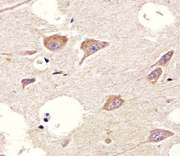 CHRM2 Antibody
