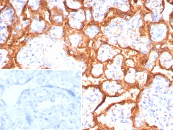 IHC staining of FFPE human placental tissue with Growth Hormone antibody (clone GH/8215R). Inset: PB