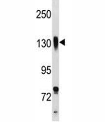 Integrin beta 1 antibody western blot analysis in NCI-H292 lysate. Predicted molecular weight: 88/13