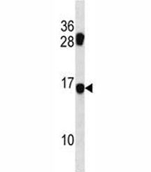 MDS1 Antibody