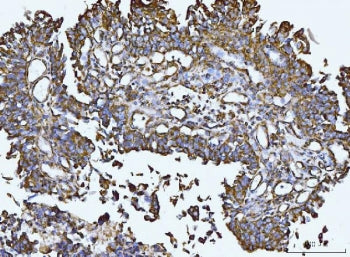 Integrin linked protein kinase Antibody / ILK