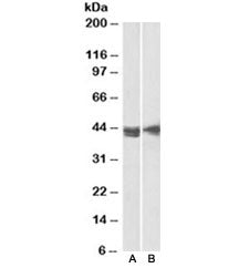 Western blot testing of Jurkat [A] and MOLT4 [B] lysates with CD123 antibody at 2ug/ml. Predicted mo