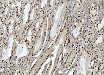 RBM15 Antibody / OTT1