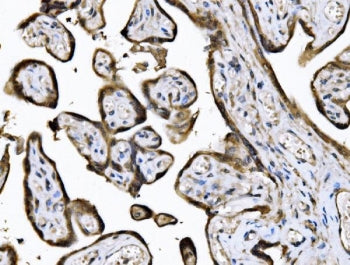 IHC staining of FFPE human placental tissue with KIF2A antibody. HIER: boil tissue sections in pH8 E