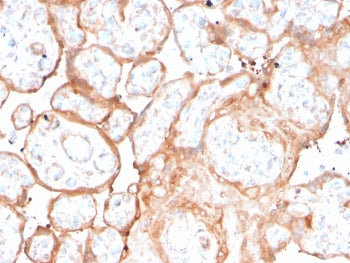 IHC staining of FFPE human placenta with recombinant Aurora B antibody (clone rAURKB/1592). HIER: bo