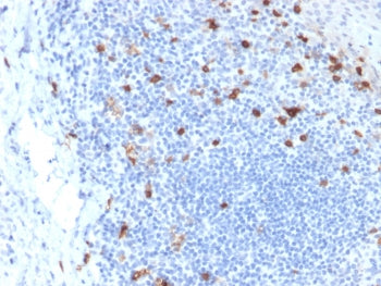 Integrin alpha E Antibody / CD103