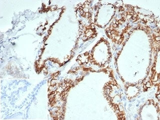 IHC staining of FFPE human thyroid tissue with recombinant Cadherin 16 antibody (clone CHD16/7027R) 
