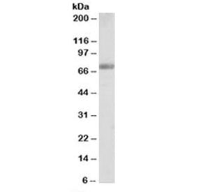 Western blot testing of human testis lysate with FBP17 antibody at 0.25ug/ml. Predicted molecular we