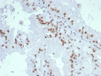 MLH1 Antibody / MutL Homolog 1
