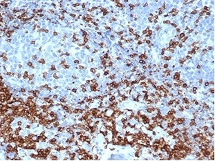 IHC staining of FFPE human tonsil tissue with recombinant CD3e antibody (clone C3e/4652R) at 2ug/ml 