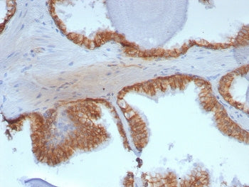 CTNNB1 Antibody / Beta Catenin