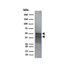 Western blot testing of human MCF7 cell lysate with recombinant GATA3 antibody (clone GATA3/4550R). 
