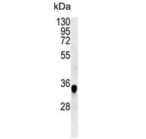 CYRIA Antibody / FAM49A