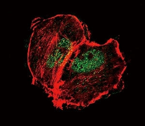 Phospho-TSC2 / Tuberin Antibody (pS664)