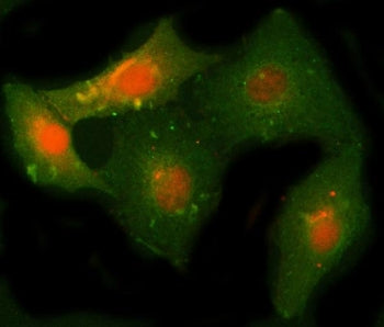 Immunofluorescent staining of FFPE human A549 cells with NCAPH antibody (red) and Beta Tubulin mAb (