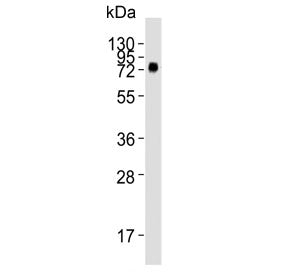 Western blot testing of human WiDr cell lysate with CD73 antibody. Predicted molecular weight: 65-70